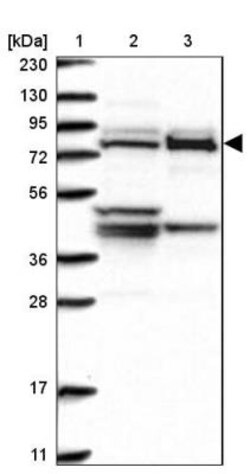 Methylmalonyl Coenzyme A mutase Antibody, Novus Biologicals 25 &mu;L; Unlabeled:Antibodies,