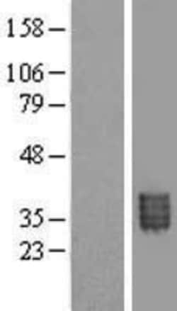 Novus Biologicals™ methyltransferase like 9 Overexpression Lysate