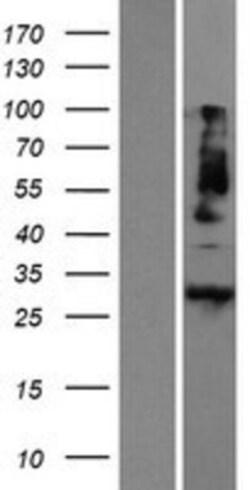 Novus Biologicals™ Meteorin Overexpression Lysate