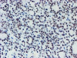 METT10D Antibody (OTI3B5), Novus Biologicals 0.1mL; Unlabeled:Antibodies,