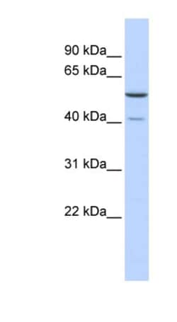METT5D1 Antibody, Novus Biologicals 100&mu;L; Unlabeled:Antibodies, Polyclonal