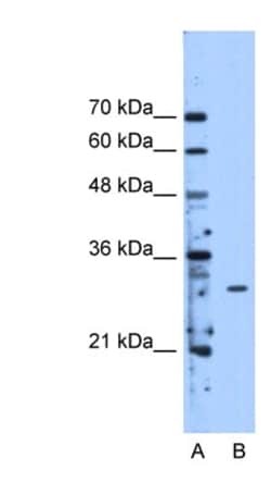 METTL1 Antibody, Novus Biologicals:Antibodies:Primary Antibodies