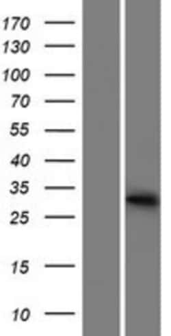 Novus Biologicals&trade;&nbsp;METTL1 Overexpression Lysate
