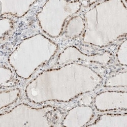 METTL11B Antibody, Novus Biologicals 25 &mu;L; Unlabeled:Antibodies, Polyclonal