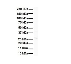 METTL11B Antibody, Novus Biologicals 100&mu;L; Unlabeled:Antibodies, Polyclonal
