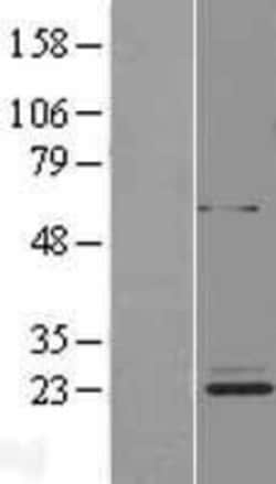 Novus Biologicals&trade;&nbsp;METTL20 Overexpression Lysate