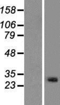 Novus Biologicals&trade;&nbsp;METTL21C Overexpression Lysate