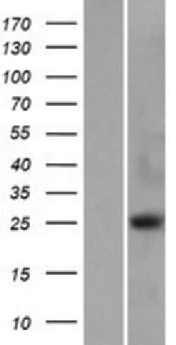 Novus Biologicals™ METTL21D Overexpression Lysate
