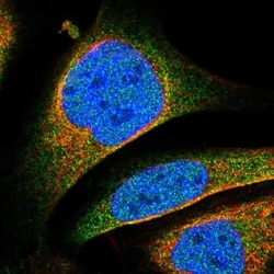 METTL21D Antibody, Novus Biologicals:Antibodies:Primary Antibodies