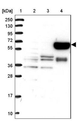 METTL25 Antibody, Novus Biologicals:Antibodies:Primary Antibodies