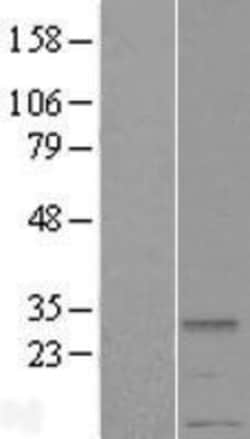 Novus Biologicals&trade;&nbsp;METTL2A Overexpression Lysate
