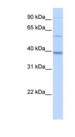 METTL2B Antibody, Novus Biologicals 100&mu;L; Unlabeled:Antibodies, Polyclonal