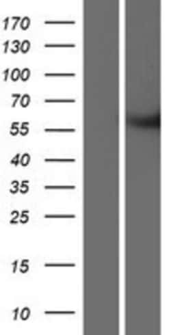 Novus Biologicals&trade;&nbsp;METTL2B Overexpression Lysate