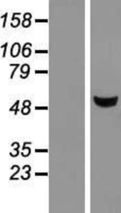 Novus Biologicals&trade;&nbsp;METTL4 Overexpression Lysate