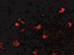 MEX3A Antibody - BSA Free, Novus Biologicals 0.1mg; Unlabeled:Antibodies,