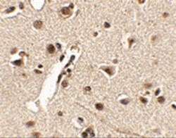 MEX3A Antibody - BSA Free, Novus Biologicals 0.1mg; Unlabeled:Antibodies,