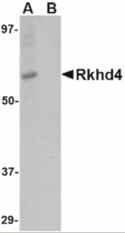 MEX3A Antibody - BSA Free, Novus Biologicals 0.1mg; Unlabeled:Antibodies,
