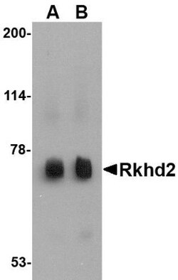 MEX3C Antibody - BSA Free, Novus Biologicals 0.1mg; Unlabeled:Antibodies,