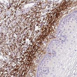 MFAP4 Antibody, Novus Biologicals 0.1mL; Unlabeled:Antibodies, Polyclonal
