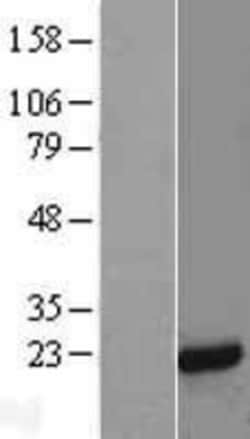 Novus Biologicals&trade;&nbsp;MAGP-2/MFAP5 Overexpression Lysate