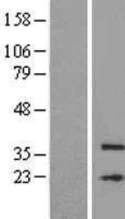 Novus Biologicals™ MFSD3 Overexpression Lysate