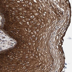 MFSD6L Antibody, Novus Biologicals:Antibodies:Primary Antibodies