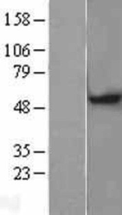 Novus Biologicals&trade;&nbsp;MGAT1 Overexpression Lysate