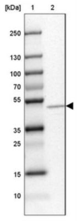 MGAT1 Antibody, Novus Biologicals 0.1mL; Unlabeled:Antibodies, Polyclonal