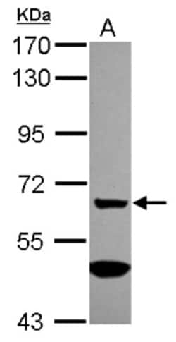 MGAT4A Antibody, Novus Biologicals 0.1mL; Unlabeled:Antibodies, Polyclonal