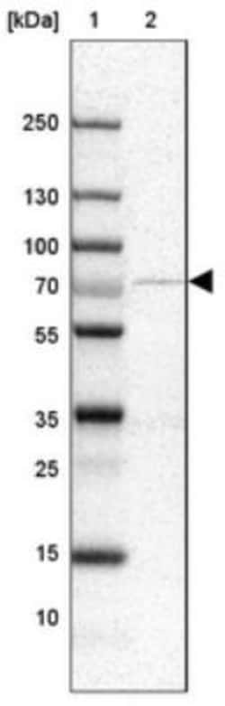 MGAT4A Antibody, Novus Biologicals 0.1mL; Unlabeled:Antibodies, Polyclonal