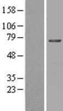 Novus Biologicals™ MGAT4B Overexpression Lysate