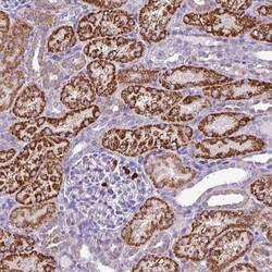 MGAT4B Antibody, Novus Biologicals 0.1mL; Unlabeled:Antibodies, Polyclonal