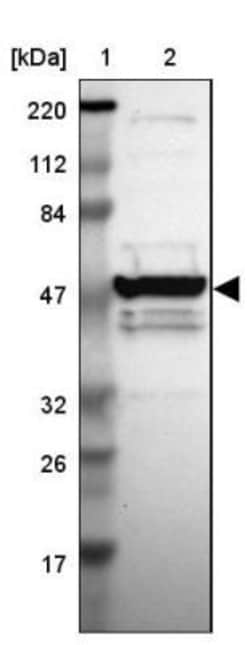 MGC13138 Antibody, Novus Biologicals 25 &mu;L | Buy Online | Novus Biologicals | Fisher Scientific