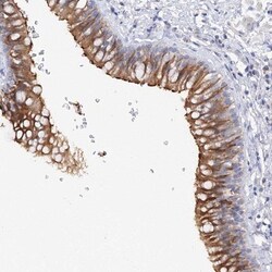 MGC16471 Antibody, Novus Biologicals 0.1mL; Unlabeled:Antibodies, Polyclonal