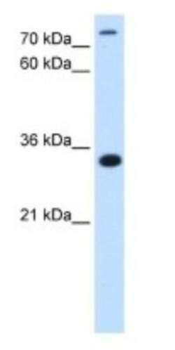 MGC16471 Antibody, Novus Biologicals:Antibodies:Primary Antibodies