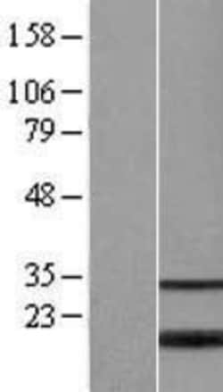 Novus Biologicals&trade;&nbsp;MGC20410 Overexpression Lysate