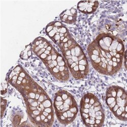 MGC4172 Antibody, Novus Biologicals 0.1mL; Unlabeled:Antibodies, Polyclonal
