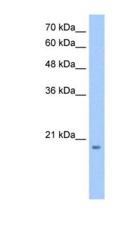 MGC4172 Antibody, Novus Biologicals 100&mu;L; Unlabeled:Antibodies, Polyclonal
