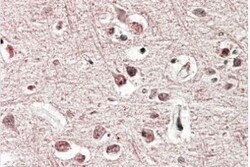 mGluR2 Antibody, Novus Biologicals 0.1mg; Unlabeled:Antibodies, Polyclonal