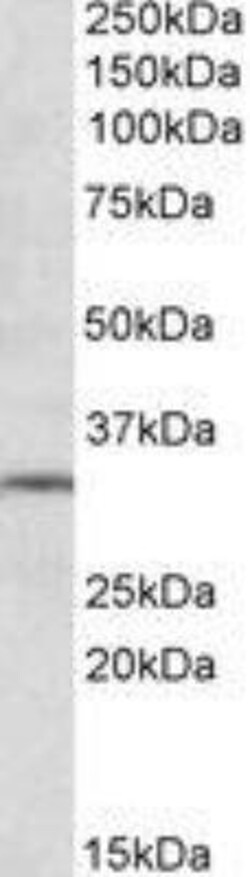 mGluR2 Antibody, Novus Biologicals 0.1mg; Unlabeled:Antibodies, Polyclonal