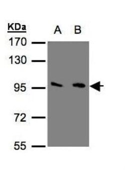 mGluR3 Antibody, Novus Biologicals 0.1mL; Unlabeled:Antibodies, Polyclonal