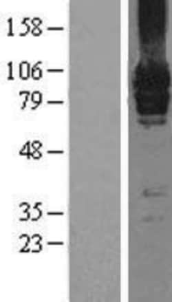Novus Biologicals&trade;&nbsp;mGluR7 Overexpression Lysate
