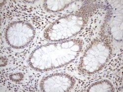 MGMT Antibody (OTI4F9), Novus Biologicals 0.1 mL | Buy Online | R&D Systems | Fisher Scientific