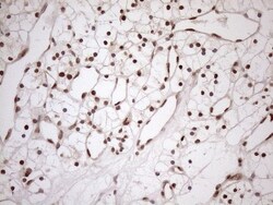 MGMT Antibody (OTI4F9), Novus Biologicals 0.1 mL | Buy Online | R&D Systems | Fisher Scientific