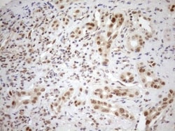 MGMT Antibody (OTI4F9), Novus Biologicals 0.1 mL | Buy Online | R&D Systems | Fisher Scientific