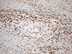 MGMT Antibody (OTI4F9), Novus Biologicals 0.1 mL | Buy Online | R&D Systems | Fisher Scientific