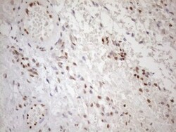 MGMT Antibody (OTI4F9), Novus Biologicals 0.1 mL | Buy Online | R&D Systems | Fisher Scientific