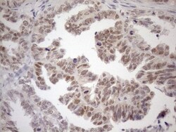 MGMT Antibody (OTI4F9), Novus Biologicals 0.1 mL | Buy Online | R&D Systems | Fisher Scientific