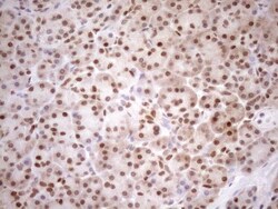 MGMT Antibody (OTI4F9), Novus Biologicals 0.1 mL | Buy Online | R&D Systems | Fisher Scientific
