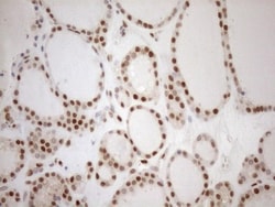 MGMT Antibody (OTI4F9), Novus Biologicals 0.1 mL | Buy Online | R&D Systems | Fisher Scientific